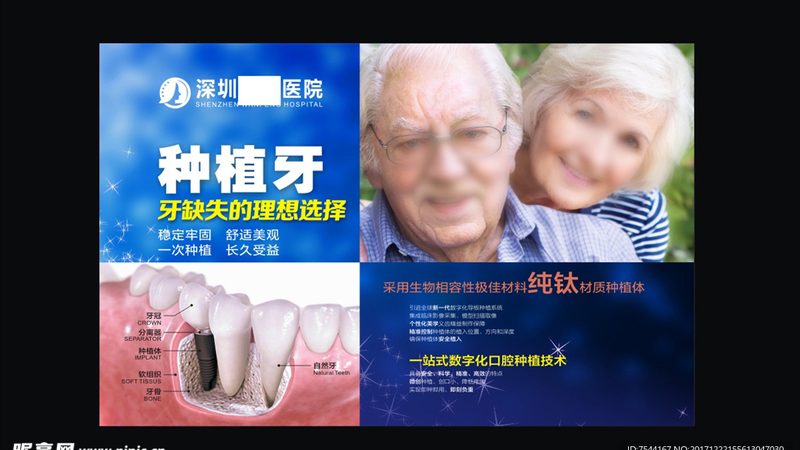根管治疗填充材料，价格与性能的平衡之道